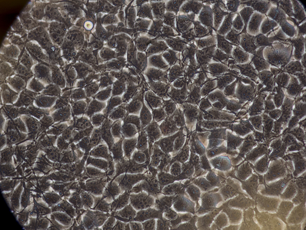 Cells under a microscope in a UW Medicine immunity lab.